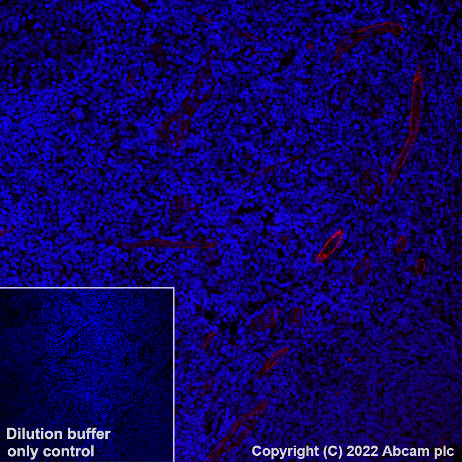 Immunohistochemistry (Formalin/PFA-fixed paraffin-embedded sections) - Alexa Fluor® 647 Anti-CD146 antibody [EPR3208] (AB305213), expandable thumbnail