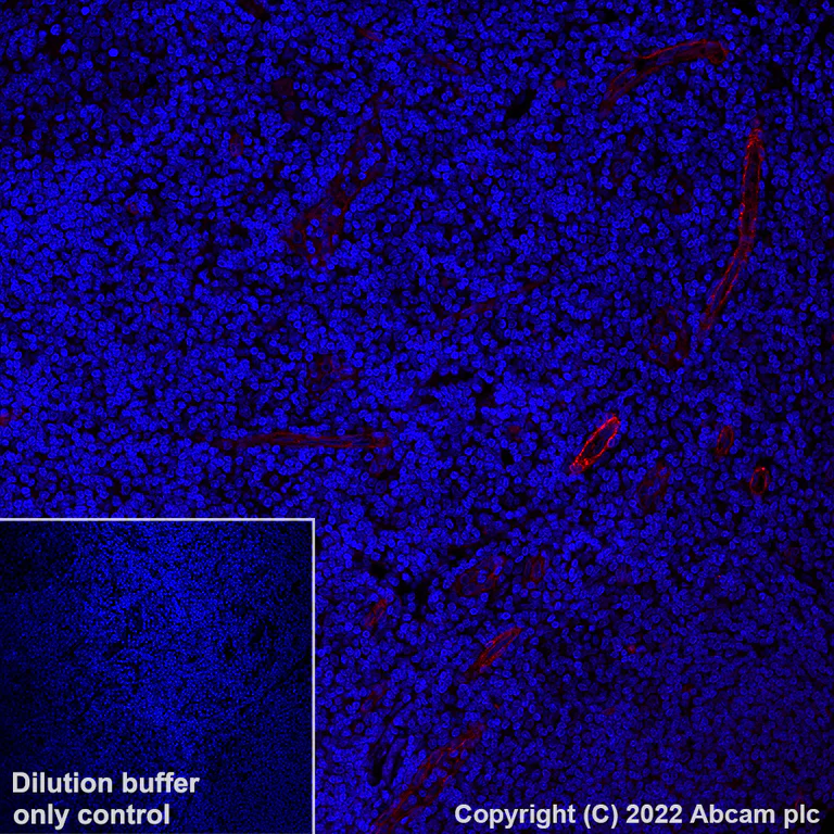Immunohistochemistry (Formalin/PFA-fixed paraffin-embedded sections) - Alexa Fluor® 647 Anti-CD146 antibody [EPR3208] (AB305213)