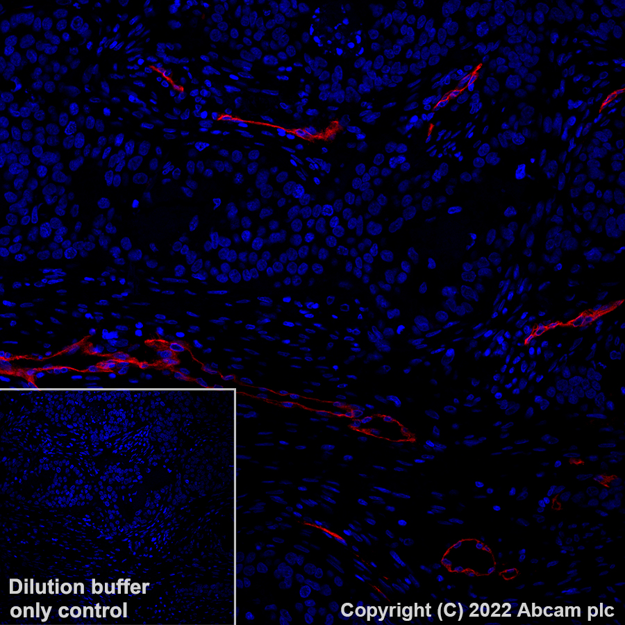 Immunohistochemistry (Formalin/PFA-fixed paraffin-embedded sections) - Alexa Fluor® 647 Anti-CD146 antibody [EPR3208] (AB305213), expandable thumbnail