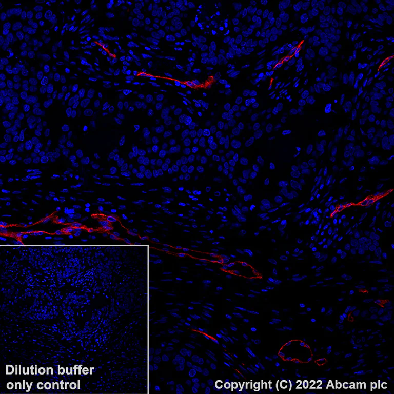Immunohistochemistry (Formalin/PFA-fixed paraffin-embedded sections) - Alexa Fluor® 647 Anti-CD146 antibody [EPR3208] (AB305213)