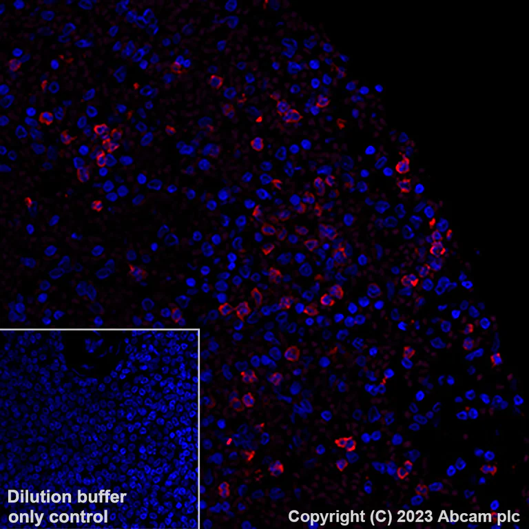 Immunohistochemistry (Formalin/PFA-fixed paraffin-embedded sections) - Alexa Fluor® 647 Anti-CD15 antibody [EPR9521] (AB313675)