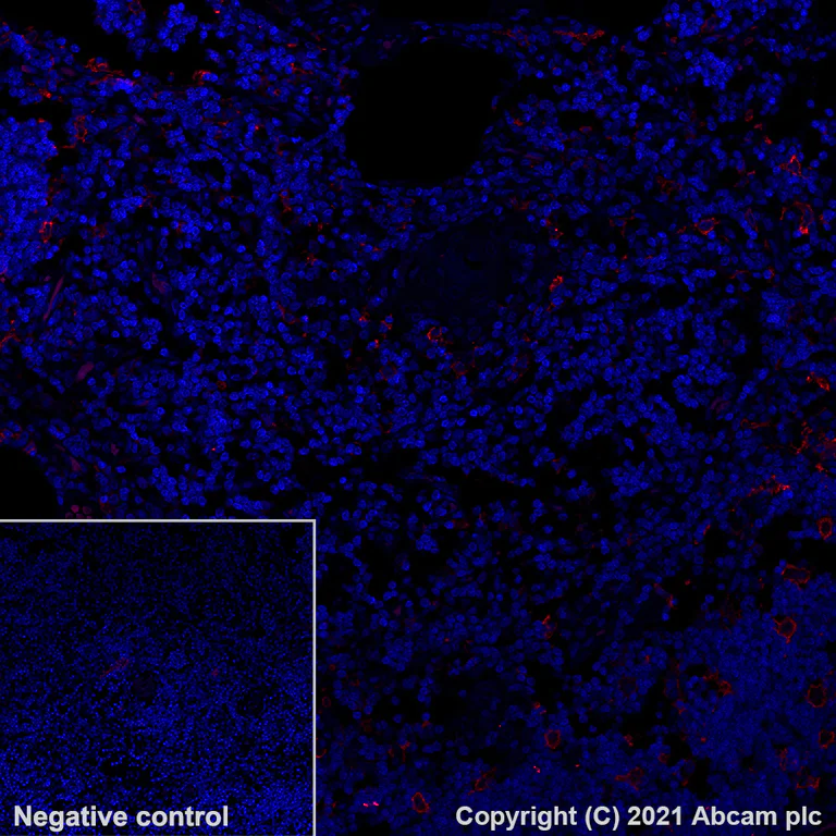 Immunohistochemistry (Formalin/PFA-fixed paraffin-embedded sections) - Alexa Fluor® 647 Anti-CD16 antibody [EPR16784] - C-terminal (AB283695)