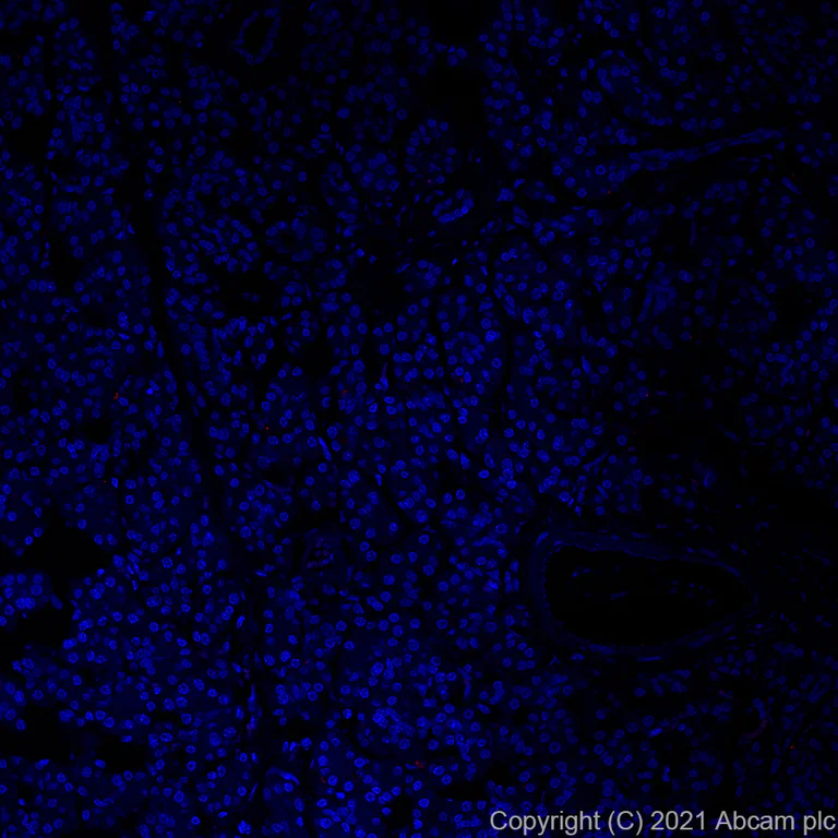 Immunohistochemistry (Formalin/PFA-fixed paraffin-embedded sections) - Alexa Fluor® 647 Anti-CD16 antibody [EPR16784] - C-terminal (AB283695)