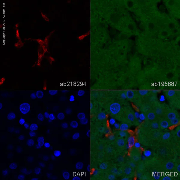 Immunohistochemistry (Formalin/PFA-fixed paraffin-embedded sections) - Alexa Fluor® 647 Anti-CD163 antibody [EPR14643-36] - C-terminal (AB218294)
