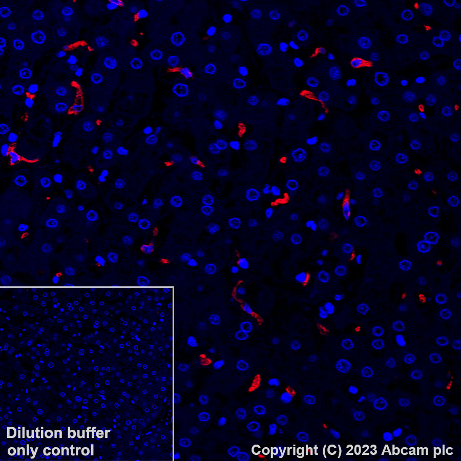 Alexa Fluor® 647 Anti-CD163 antibody [EPR19518] (ab313666