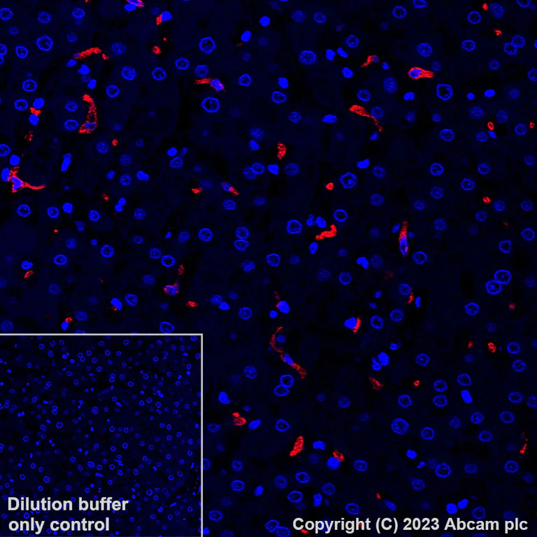 Immunohistochemistry (Formalin/PFA-fixed paraffin-embedded sections) - Alexa Fluor® 647 Anti-CD163 antibody [EPR19518] (AB313666)