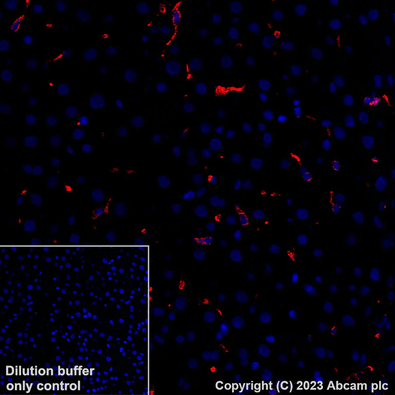 Immunohistochemistry (Formalin/PFA-fixed paraffin-embedded sections) - Alexa Fluor® 647 Anti-CD163 antibody [EPR19518] (AB313666)