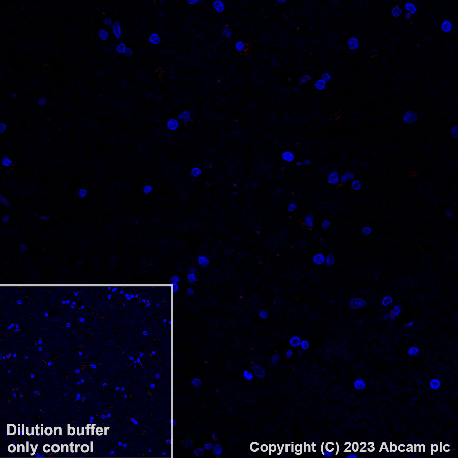 Immunohistochemistry (Formalin/PFA-fixed paraffin-embedded sections) - Alexa Fluor® 647 Anti-CD163 antibody [EPR19518] (AB313666)
