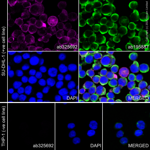 Alexa Fluor® 647 Anti-CD163 antibody [EPR29058-507] (ab325692) | Abcam