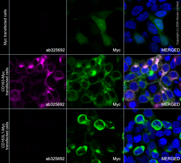 Alexa Fluor® 647 Anti-CD163 antibody [EPR29058-507] (ab325692) | Abcam