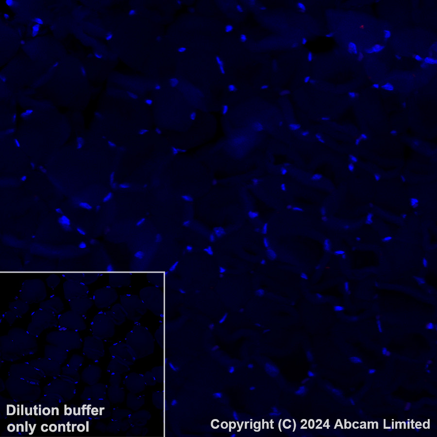 Immunohistochemistry (Formalin/PFA-fixed paraffin-embedded sections) - Alexa Fluor® 647 Anti-CD168 antibody [EPR4054] (AB319128)