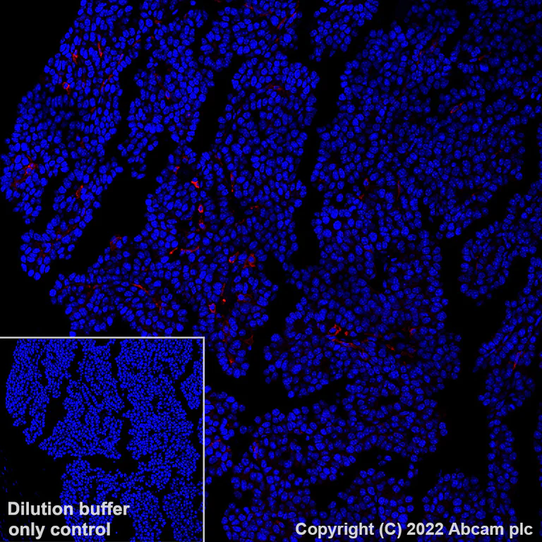 Immunohistochemistry (Formalin/PFA-fixed paraffin-embedded sections) - Alexa Fluor® 647 Anti-CD16+CD32 antibody [EPR23501-203] (AB303478)