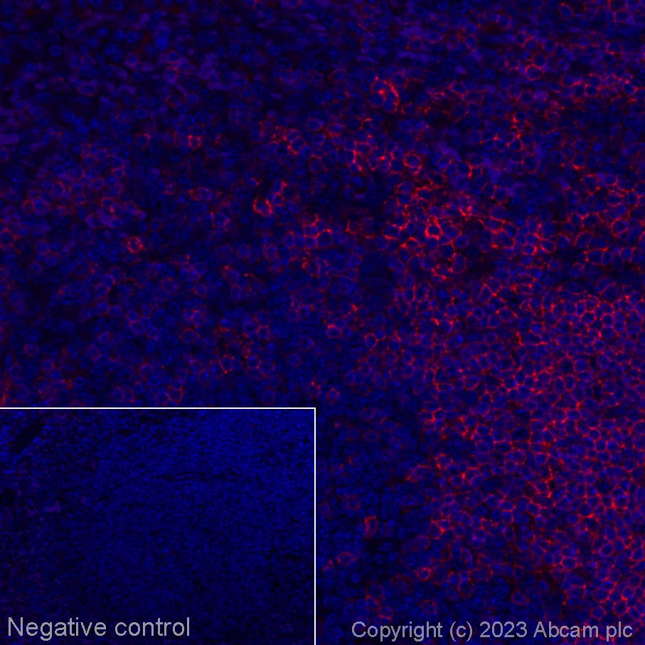 Immunohistochemistry (Formalin/PFA-fixed paraffin-embedded sections) - Alexa Fluor® 647 Anti-CD19 antibody [EPR23174-145] (AB314289), expandable thumbnail
