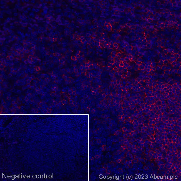 Immunohistochemistry (Formalin/PFA-fixed paraffin-embedded sections) - Alexa Fluor® 647 Anti-CD19 antibody [EPR23174-145] (AB314289)