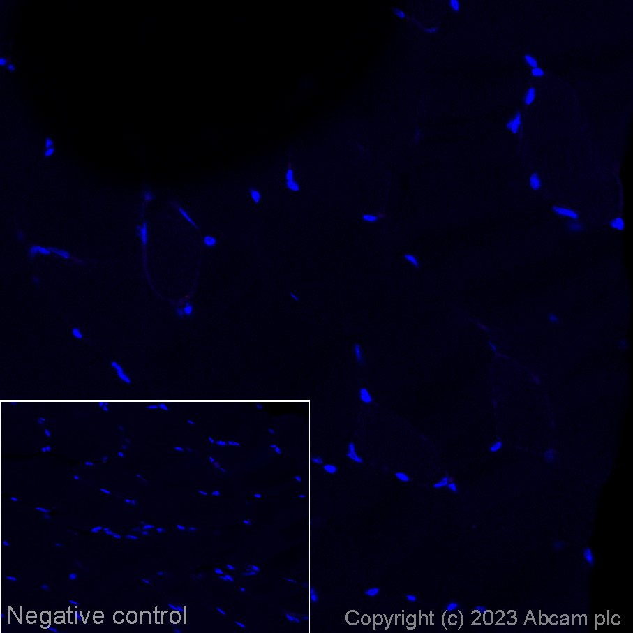 Immunohistochemistry (Formalin/PFA-fixed paraffin-embedded sections) - Alexa Fluor® 647 Anti-CD19 antibody [EPR23174-145] (AB314289), expandable thumbnail