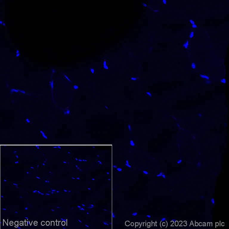 Immunohistochemistry (Formalin/PFA-fixed paraffin-embedded sections) - Alexa Fluor® 647 Anti-CD19 antibody [EPR23174-145] (AB314289)