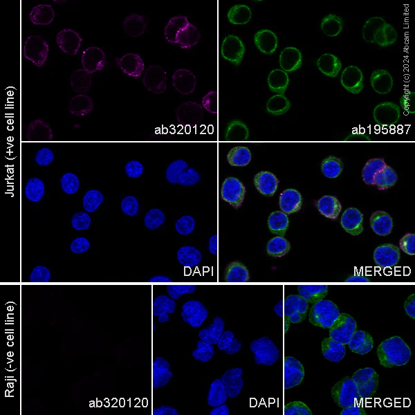 Immunocytochemistry/ Immunofluorescence - Alexa Fluor® 647 Anti-CD2 antibody [EPR27426-17] (AB320120)
