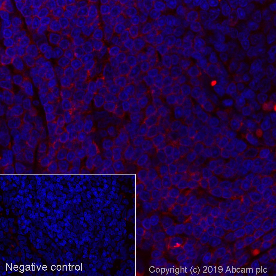 Immunohistochemistry (Formalin/PFA-fixed paraffin-embedded sections) - Alexa Fluor® 647 Anti-CD2 antibody [OX34] (AB256295), expandable thumbnail