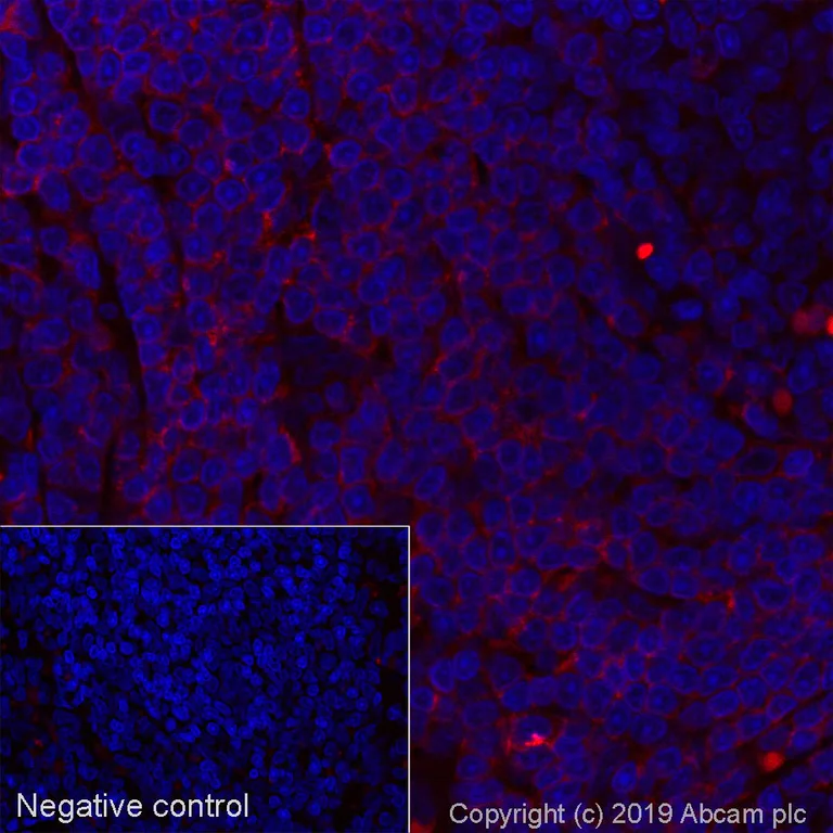 Immunohistochemistry (Formalin/PFA-fixed paraffin-embedded sections) - Alexa Fluor® 647 Anti-CD2 antibody [OX34] (AB256295)