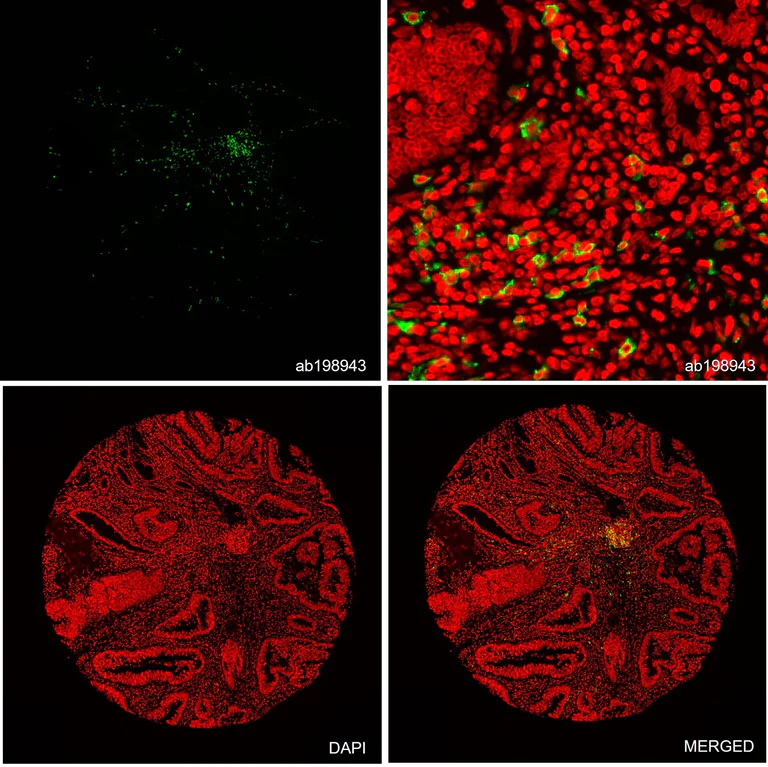 Multiplex immunohistochemistry - Alexa Fluor® 647 Anti-CD20 antibody [EP459Y] (AB198943)