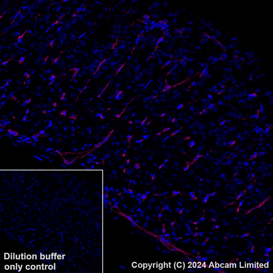 Immunohistochemistry (Formalin/PFA-fixed paraffin-embedded sections) - Alexa Fluor® 647 Anti-CD200 / OX2 antibody [EPR28087-82] (AB320785), expandable thumbnail