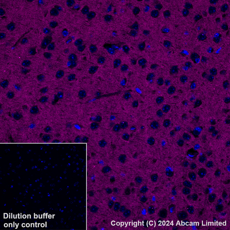 Immunohistochemistry (Formalin/PFA-fixed paraffin-embedded sections) - Alexa Fluor® 647 Anti-CD200 / OX2 antibody [EPR28087-82] (AB320785), expandable thumbnail