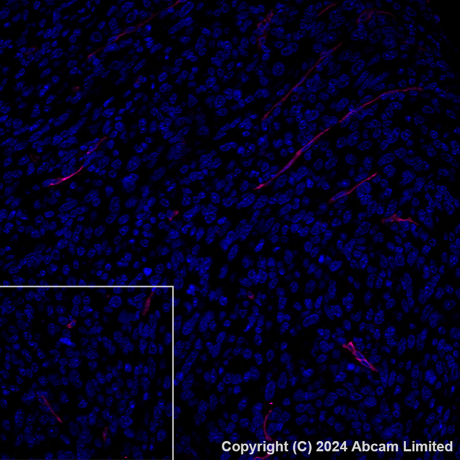 Immunohistochemistry (Formalin/PFA-fixed paraffin-embedded sections) - Alexa Fluor® 647 Anti-CD200 / OX2 antibody [EPR28087-82] (AB320785), expandable thumbnail