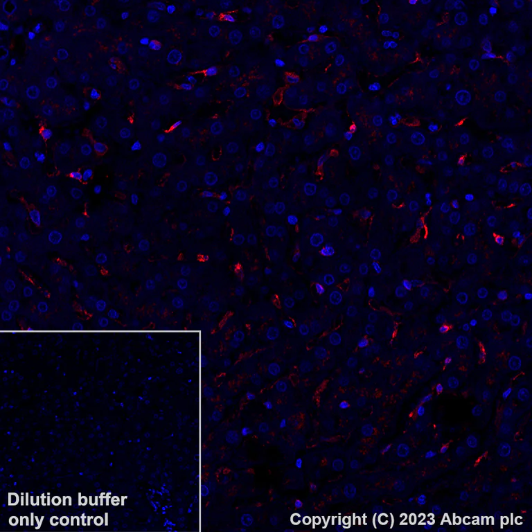 Immunohistochemistry (Formalin/PFA-fixed paraffin-embedded sections) - Alexa Fluor® 647 Anti-CD206 antibody [EPR22489-7] (AB313671)