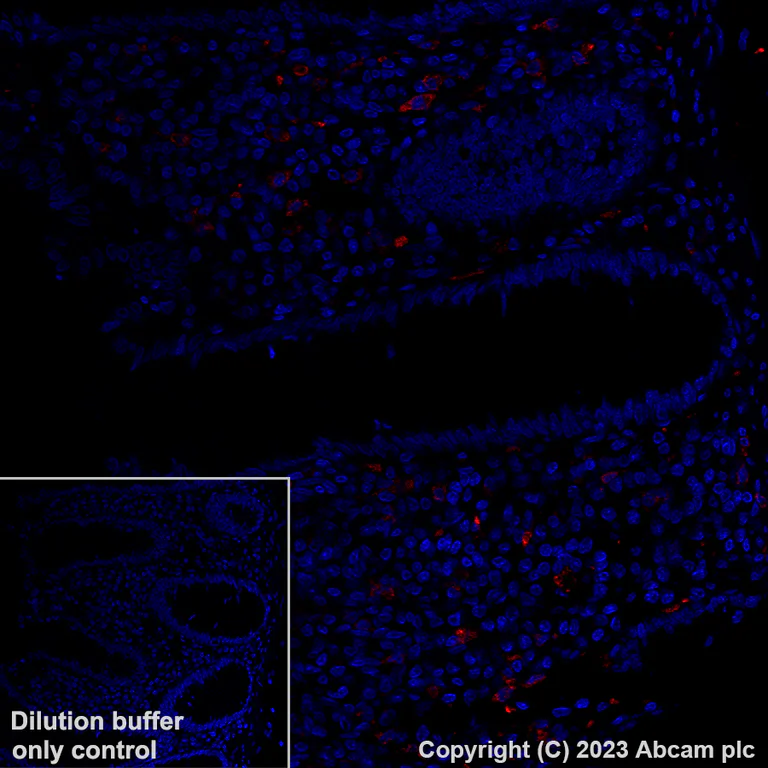 Immunohistochemistry (Formalin/PFA-fixed paraffin-embedded sections) - Alexa Fluor® 647 Anti-CD206 antibody [EPR22489-7] (AB313671)