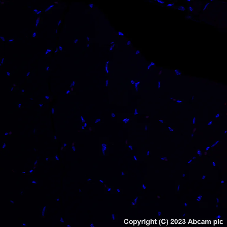 Immunohistochemistry (Formalin/PFA-fixed paraffin-embedded sections) - Alexa Fluor® 647 Anti-CD206 antibody [EPR22489-7] (AB313671)