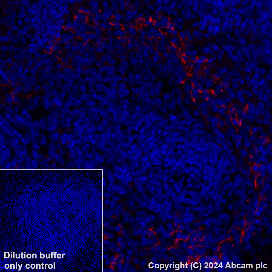 Immunohistochemistry (Formalin/PFA-fixed paraffin-embedded sections) - Alexa Fluor® 647 Anti-CD209B/DC-SIGNR1 antibody [EPR27427-87] (AB318174), expandable thumbnail