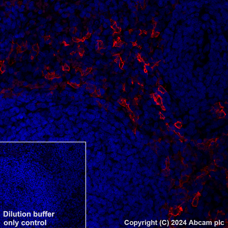Immunohistochemistry (Formalin/PFA-fixed paraffin-embedded sections) - Alexa Fluor® 647 Anti-CD209B/DC-SIGNR1 antibody [EPR27427-87] (AB318174), expandable thumbnail