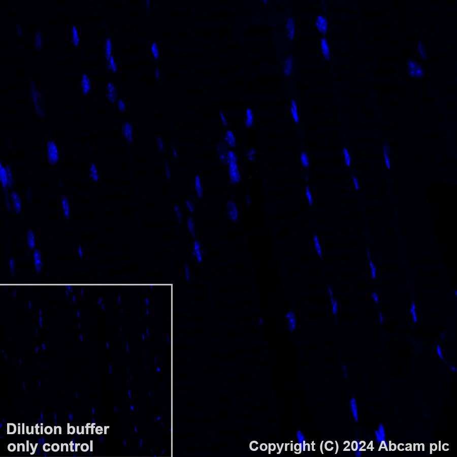 Immunohistochemistry (Formalin/PFA-fixed paraffin-embedded sections) - Alexa Fluor® 647 Anti-CD209B/DC-SIGNR1 antibody [EPR27427-87] (AB318174), expandable thumbnail