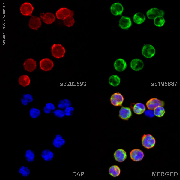 Immunocytochemistry/ Immunofluorescence - Alexa Fluor® 647 Anti-CD21 antibody [EP3093] (AB202693)