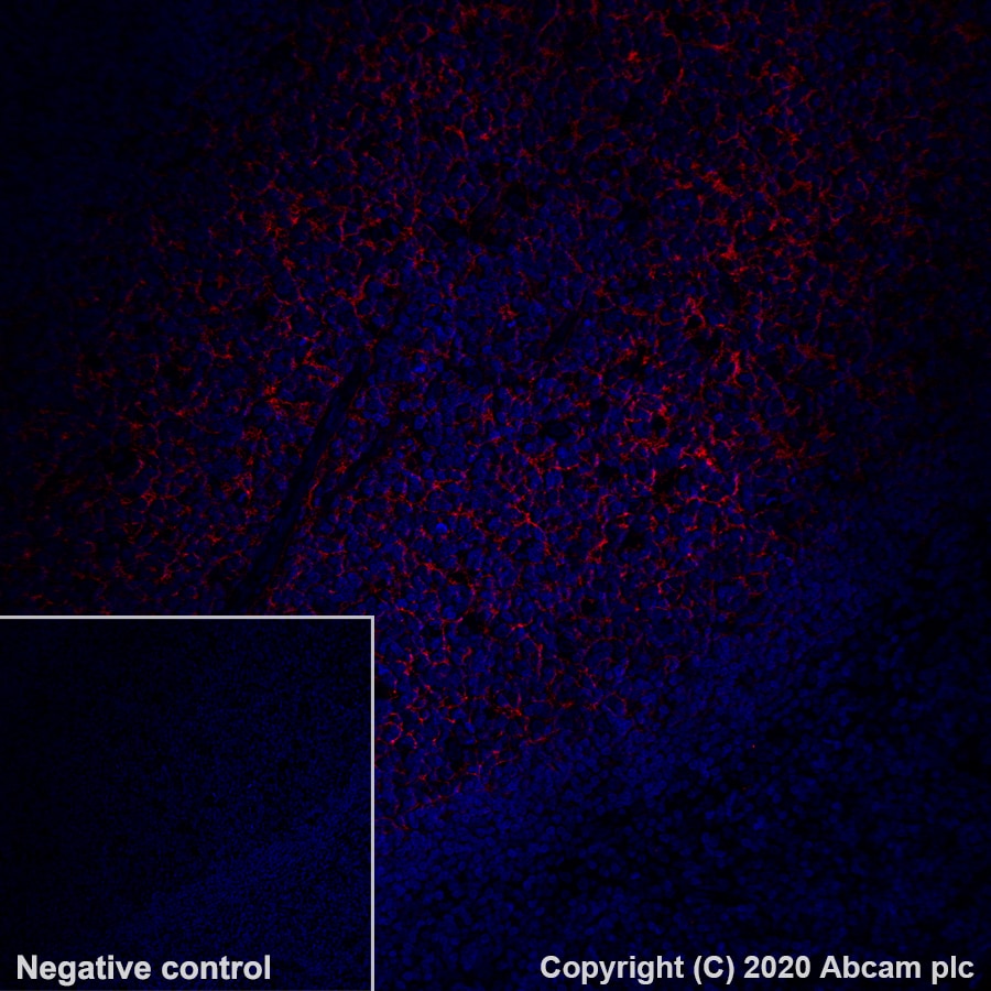 Immunohistochemistry (Formalin/PFA-fixed paraffin-embedded sections) - Alexa Fluor® 647 Anti-CD21 antibody [EP3093] (AB202693)