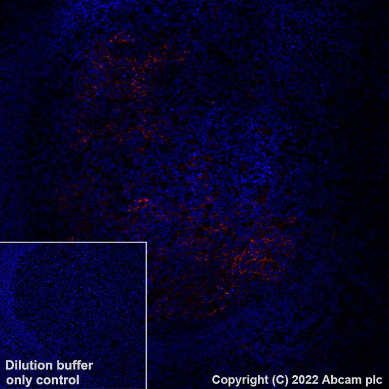 Immunohistochemistry (Formalin/PFA-fixed paraffin-embedded sections) - Alexa Fluor® 647 Anti-CD23 antibody [EPR3617] (AB305207)