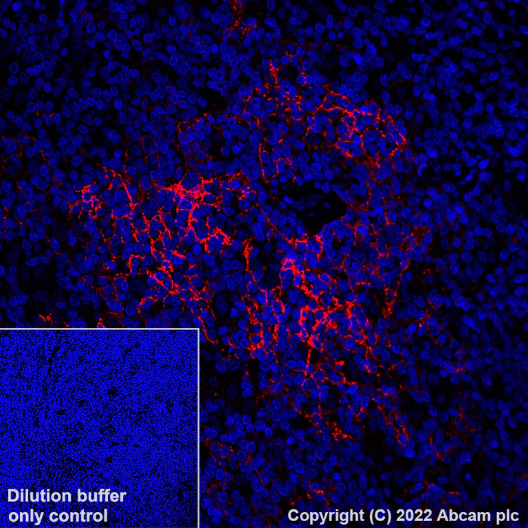 Immunohistochemistry (Formalin/PFA-fixed paraffin-embedded sections) - Alexa Fluor® 647 Anti-CD23 antibody [EPR3617] (AB305207)