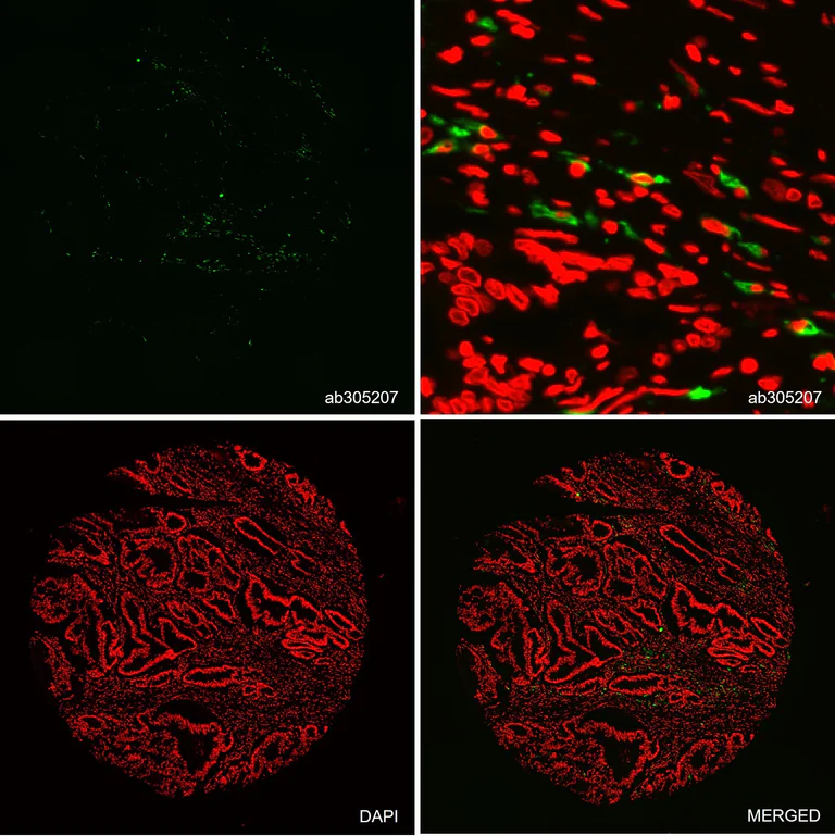 Multiplex immunohistochemistry - Alexa Fluor® 647 Anti-CD23 antibody [EPR3617] (AB305207)