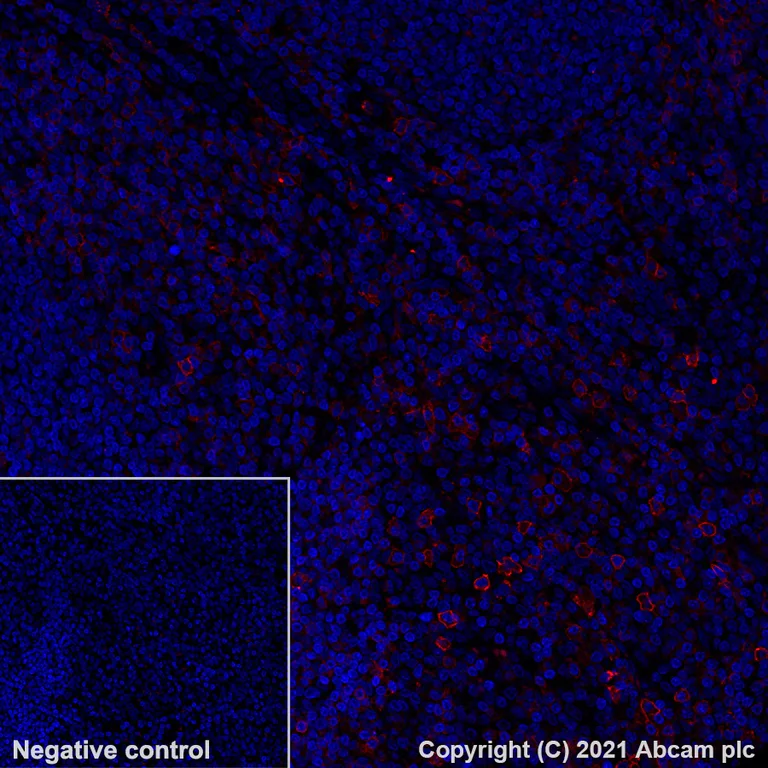 Immunohistochemistry (Formalin/PFA-fixed paraffin-embedded sections) - Alexa Fluor® 647 Anti-CD27 antibody [EPR8569] (AB283697)
