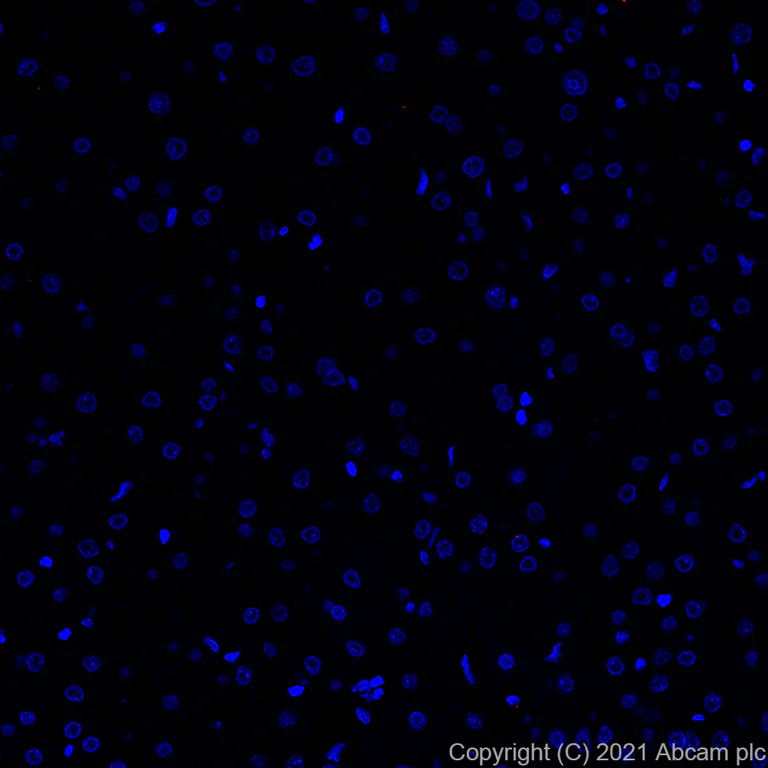 Immunohistochemistry (Formalin/PFA-fixed paraffin-embedded sections) - Alexa Fluor® 647 Anti-CD27 antibody [EPR8569] (AB283697)