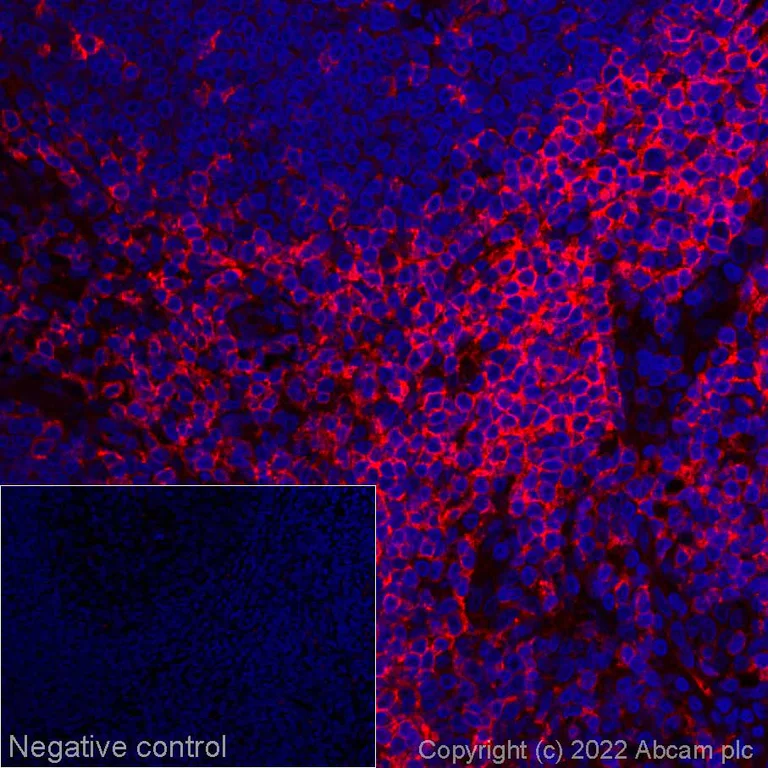 Immunohistochemistry (Formalin/PFA-fixed paraffin-embedded sections) - Alexa Fluor® 647 Anti-CD28 antibody [EPR22076] (AB288330)