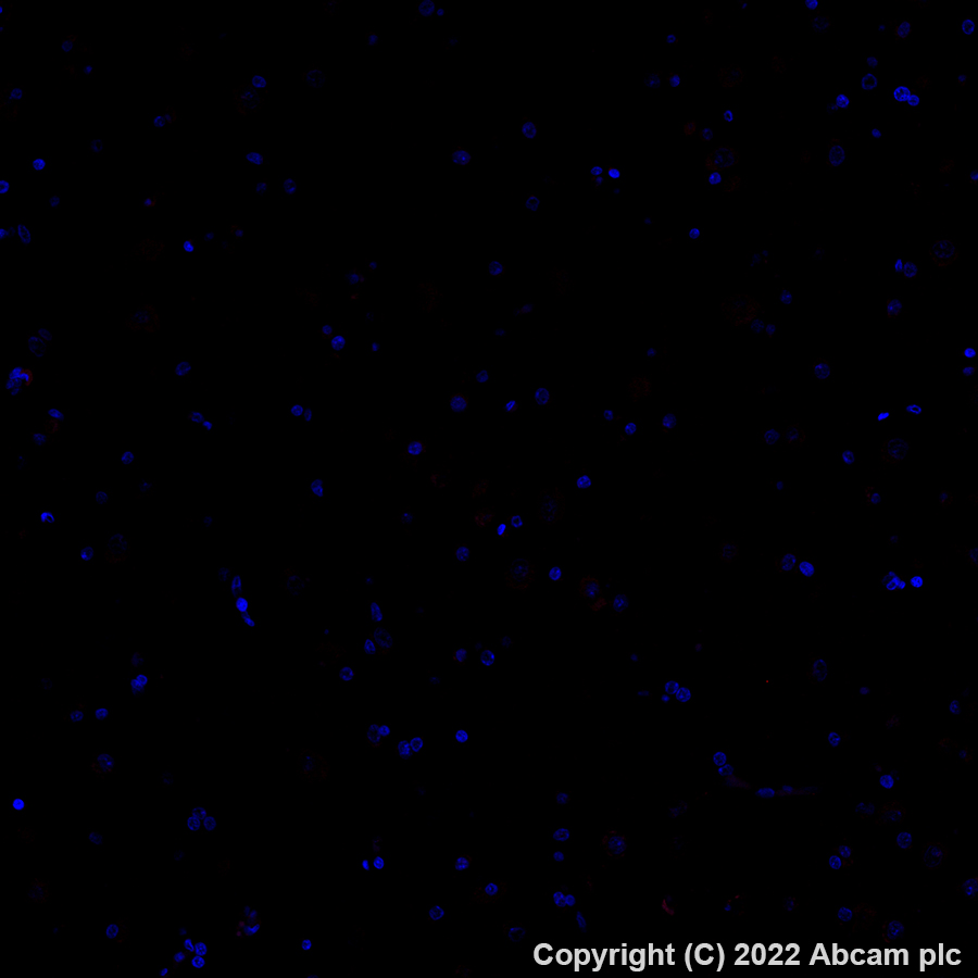 Immunohistochemistry (Formalin/PFA-fixed paraffin-embedded sections) - Alexa Fluor® 647 Anti-CD3 antibody [SP162] (AB307265), expandable thumbnail