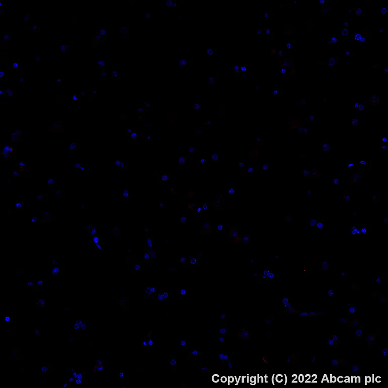 Immunohistochemistry (Formalin/PFA-fixed paraffin-embedded sections) - Alexa Fluor® 647 Anti-CD3 antibody [SP162] (AB307265)