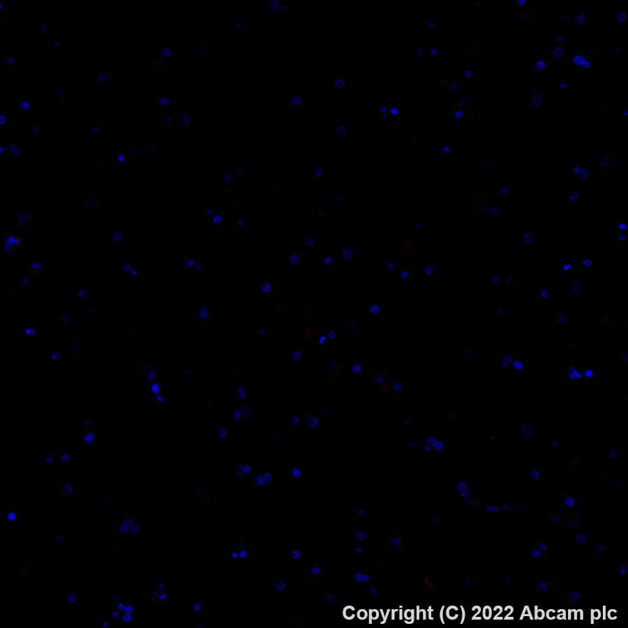 Immunohistochemistry (Formalin/PFA-fixed paraffin-embedded sections) - Alexa Fluor® 647 Anti-CD3 antibody [SP162] (ab307265), expandable thumbnail