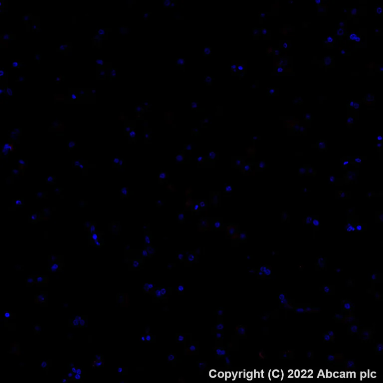 Immunohistochemistry (Formalin/PFA-fixed paraffin-embedded sections) - Alexa Fluor® 647 Anti-CD3 antibody [SP162] (AB307265)
