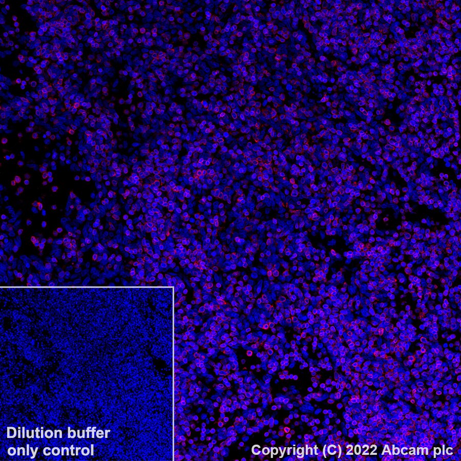 Immunohistochemistry (Formalin/PFA-fixed paraffin-embedded sections) - Alexa Fluor® 647 Anti-CD3 antibody [SP162] (AB307265), expandable thumbnail