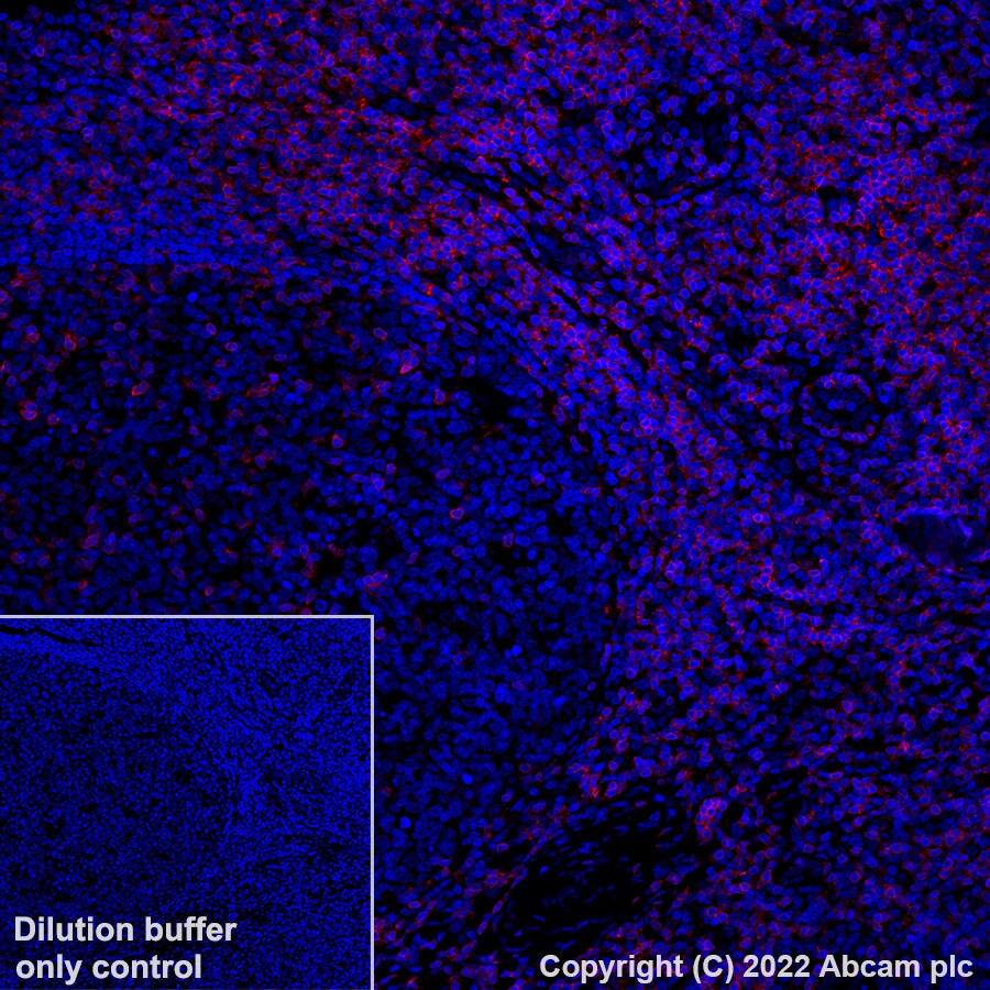 Immunohistochemistry (Formalin/PFA-fixed paraffin-embedded sections) - Alexa Fluor® 647 Anti-CD3 antibody [SP162] (AB307265), expandable thumbnail