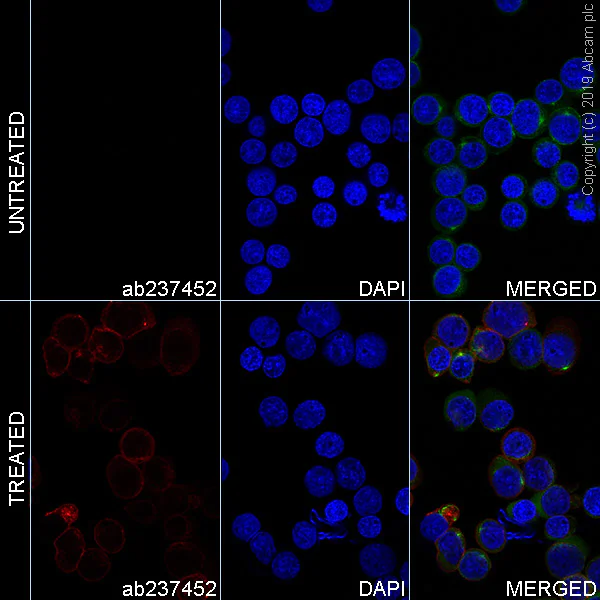 Immunocytochemistry/ Immunofluorescence - Alexa Fluor® 647 Anti-CD3 zeta (phospho Y83) antibody [EP776(2)Y] (AB237452)