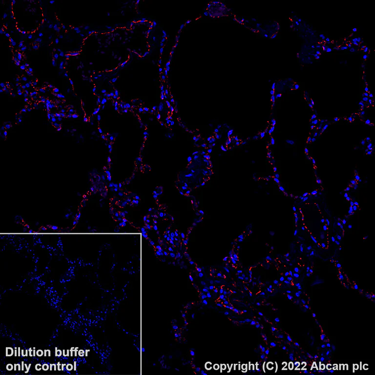 Immunohistochemistry (Formalin/PFA-fixed paraffin-embedded sections) - Alexa Fluor® 647 Anti-CD31 antibody [EPR17259] (AB305210)