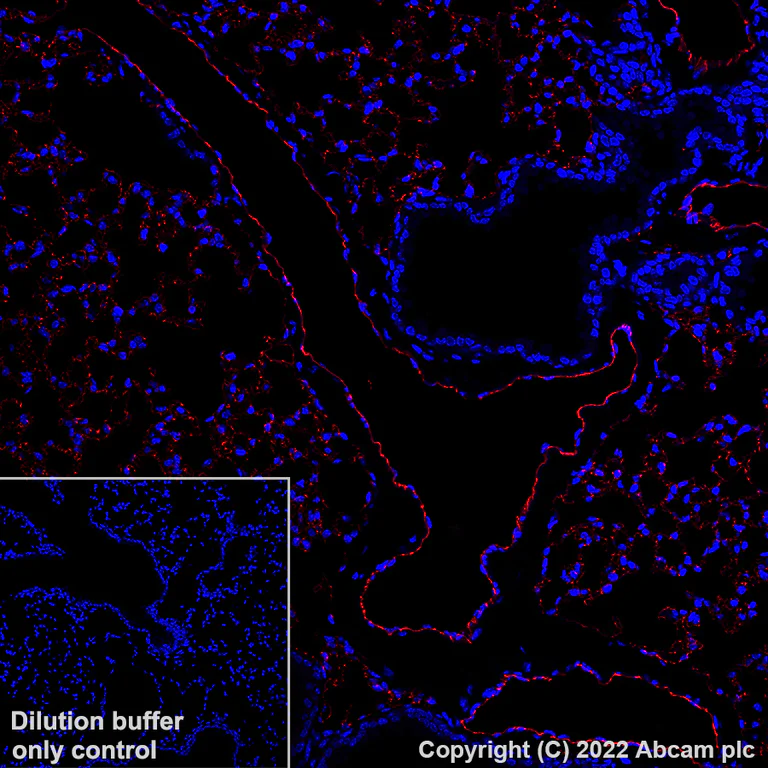 Immunohistochemistry (Formalin/PFA-fixed paraffin-embedded sections) - Alexa Fluor® 647 Anti-CD31 antibody [EPR17259] (AB305210)